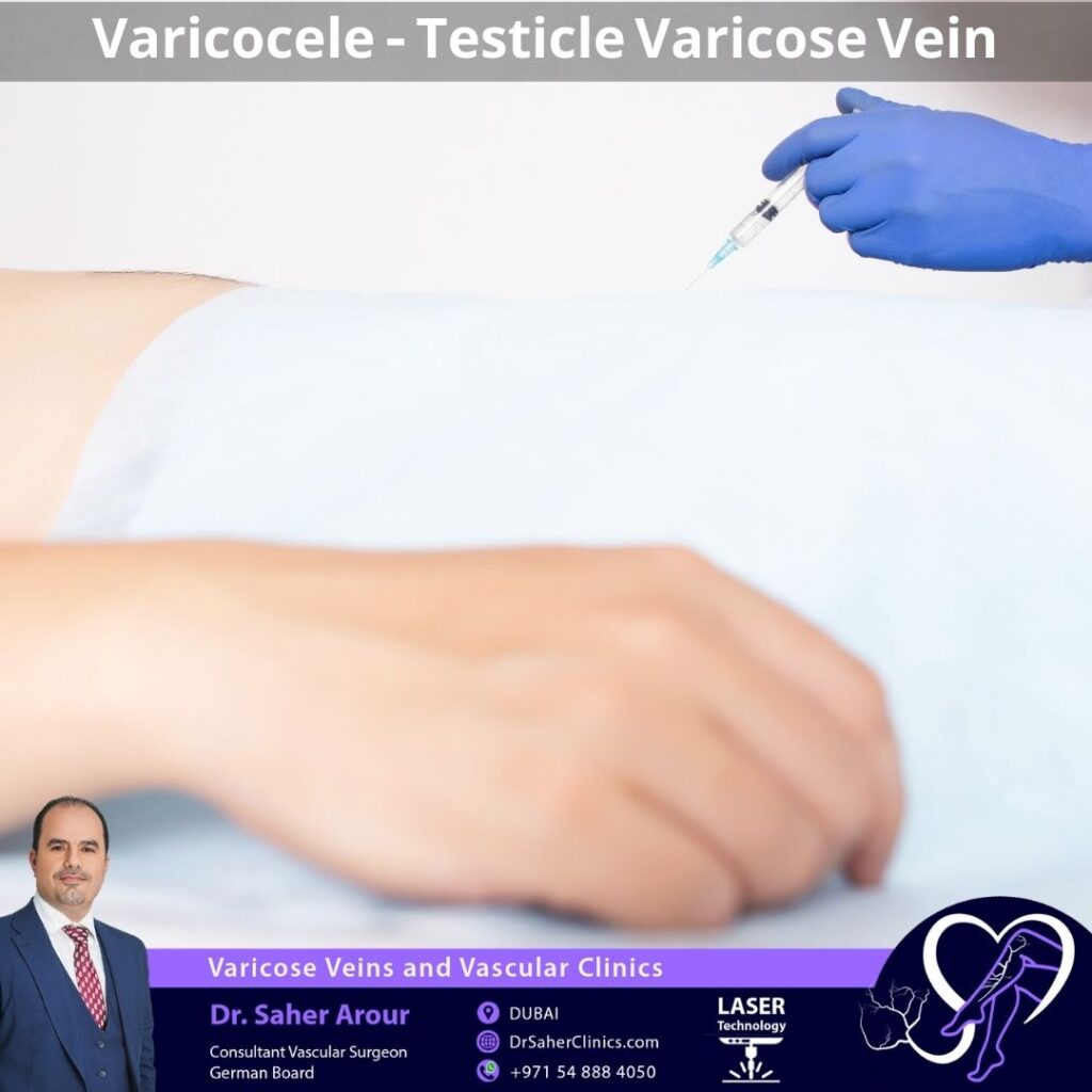 Varicocele - Testicle Varicose Vein