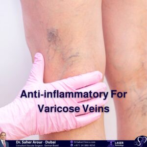 Anti-inflammatory For Varicose Veins- Types of Anti-inflammatory Medications for Relieving Varicose Veins -Guidelines and specialized doctor