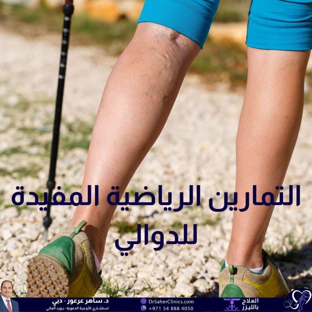 فوائد التمارين الرياضية المفيدة للدوالي أبرز التمارين الرياضية المفيدة للدوالي استشارة الطبيب أبرز الأطباء المختصين