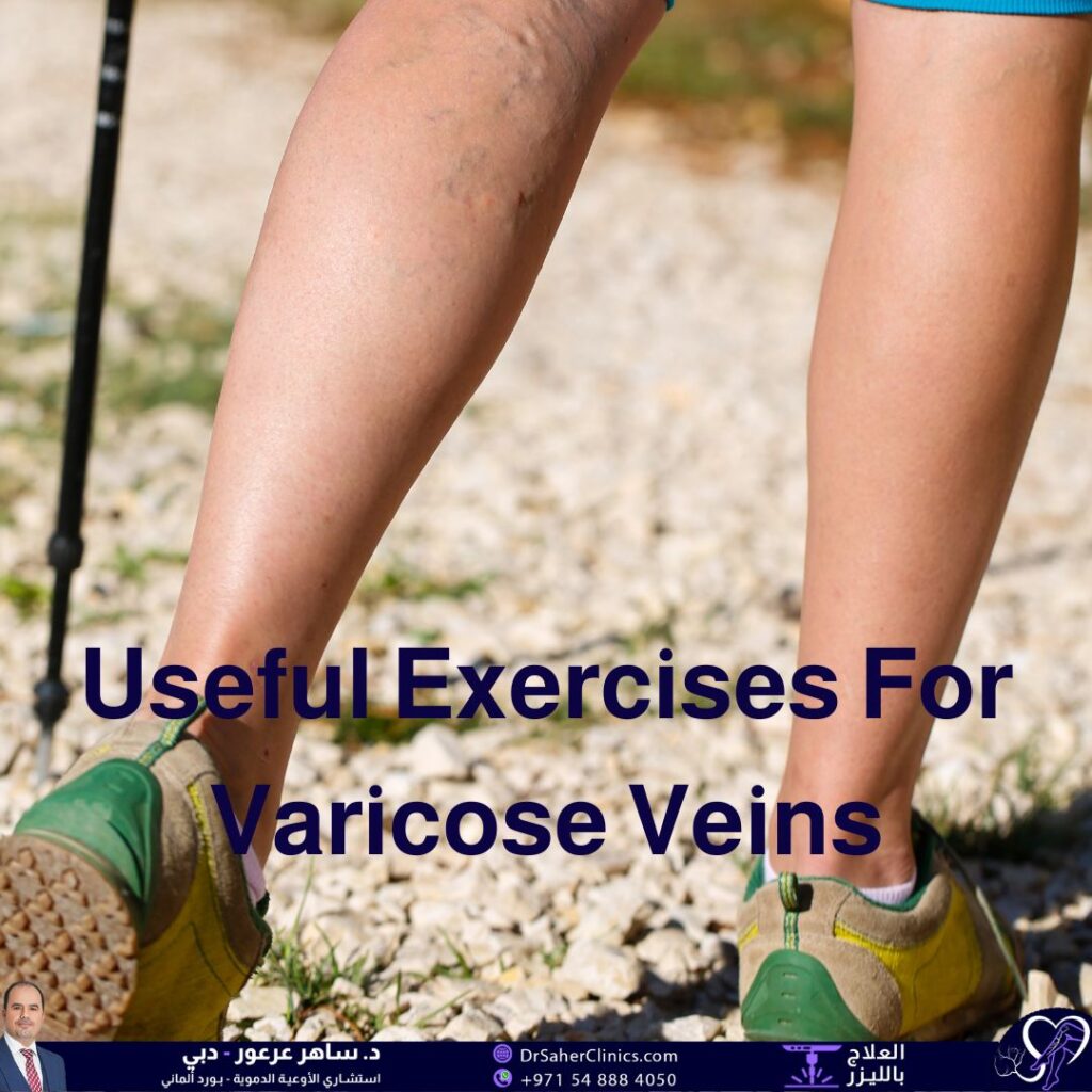 Benefits of Useful Exercises for Varicose Veins The Most Useful Exercises For Varicose Veins the most important specialized doctor