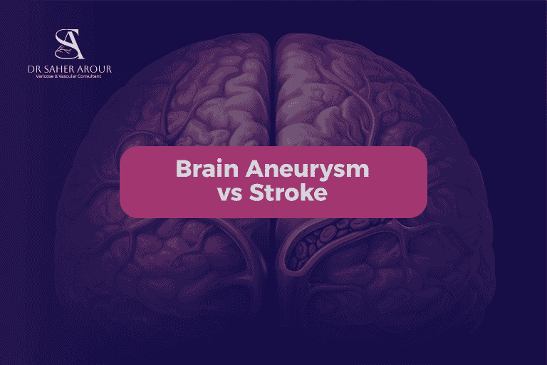 Brain Aneurysm vs Stroke