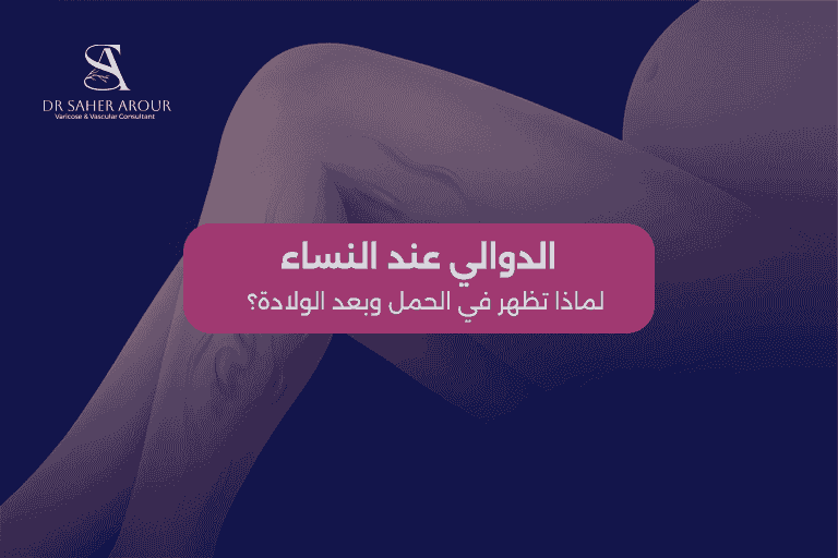 الدوالي عند النساءلماذا-تظهر-في-الحمل-وبعد-الولادة؟