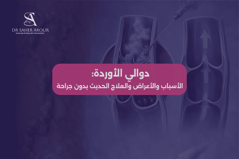 دوالي الأوردة