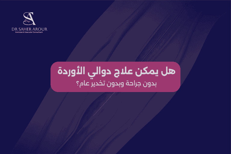 هل يمكن علاج دوالي الأوردة بدون جراحة وبدون تخدير عام؟