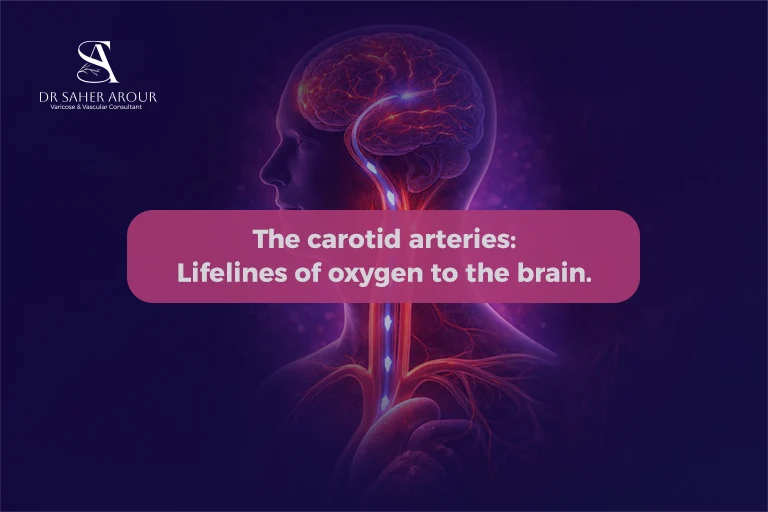 Carotid Artery Stenosis Narrowing Before a Stroke Occurs