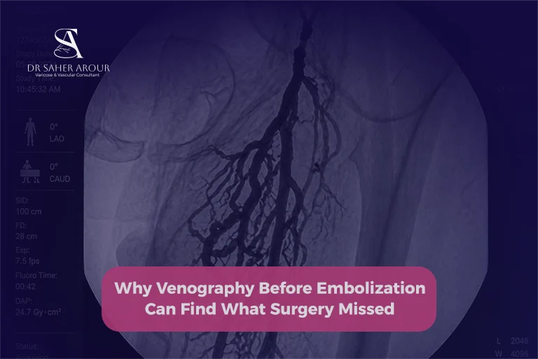 Why Venography Before Embolization Can Find What Surgery Missed