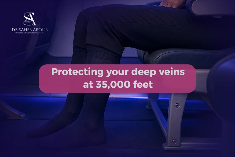 Long-Haul Flights and Varicose Veins What Actually Happens in Your Veins