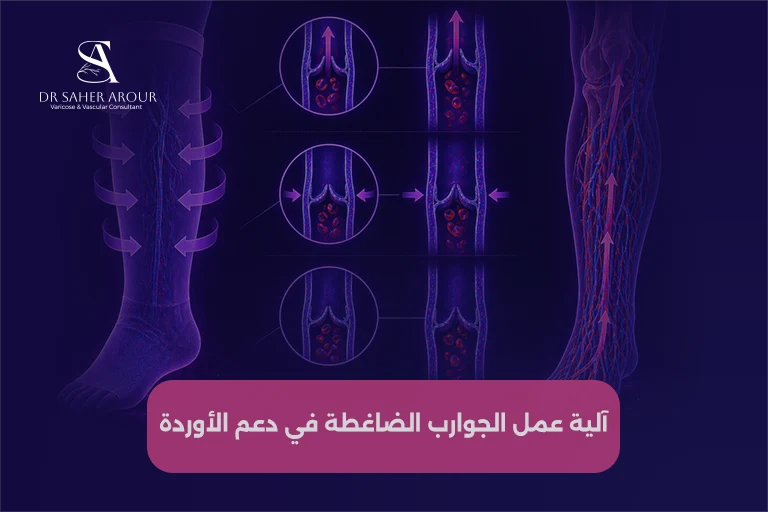 الجوارب الضاغطة (خيار شائع لتخفيف الأعراض)