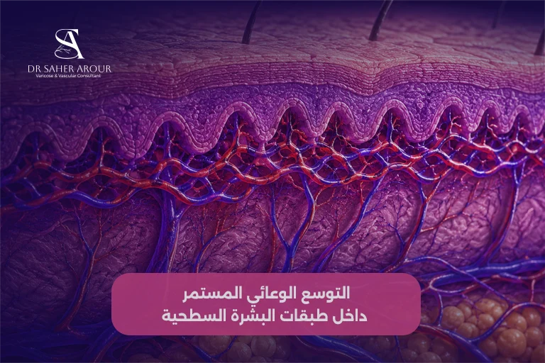 الأسباب الوعائية لظهور الأوردة على الوجه
