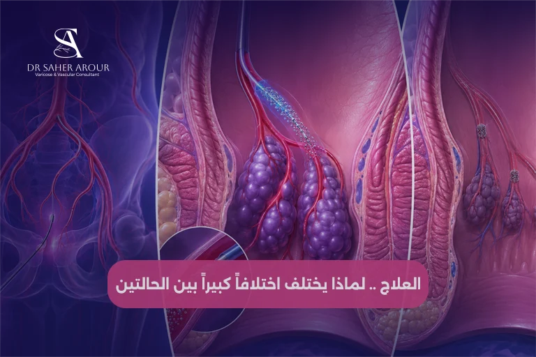 العلاج .. لماذا يختلف اختلافاً كبيراً بين الحالتين