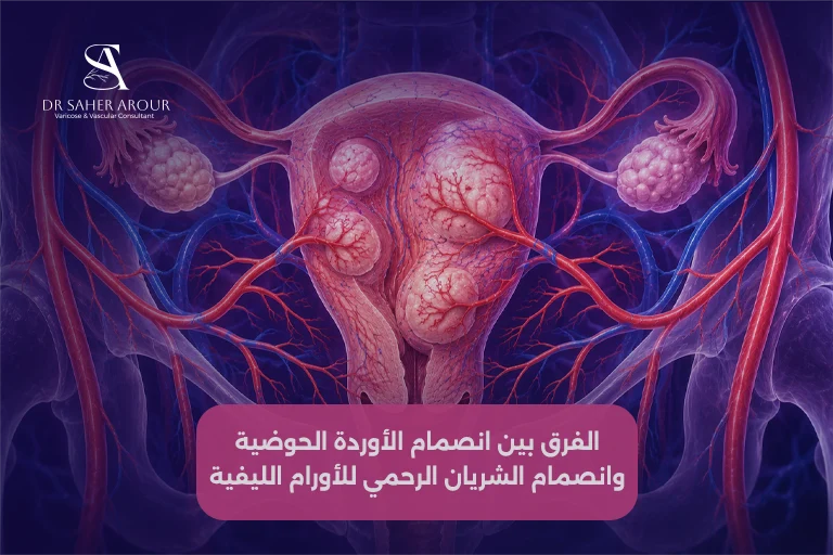  الفرق بين انصمام الأوردة الحوضية وانصمام الشريان الرحمي للأورام الليفية