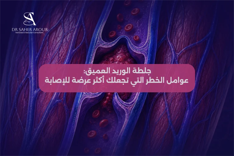 جلطة الوريد العميق عوامل الخطر التي تجعلك أكثر عرضة للإصابة