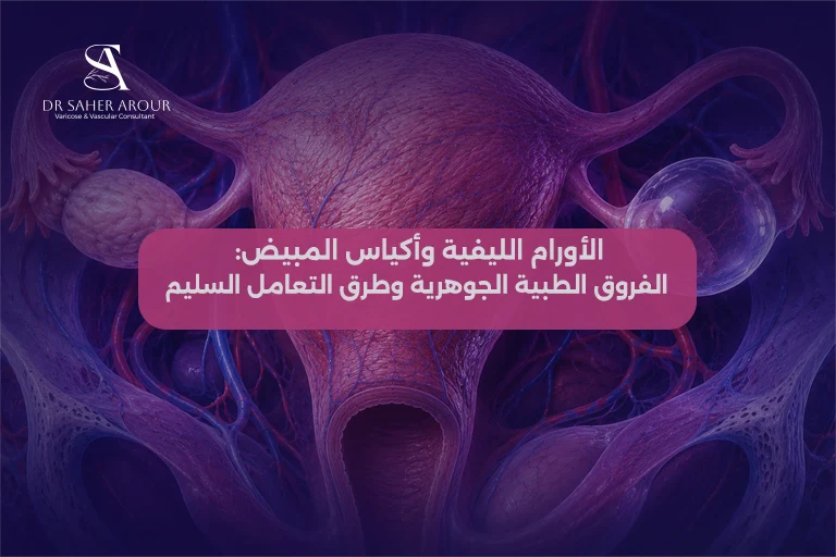الأورام الليفية وأكياس المبيض