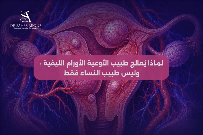 لماذا يعالج طبيب الاوعية الاورام الليفية