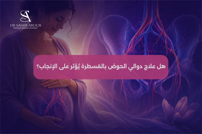 هل علاج دوالي الحوض بالقسطرة يُؤثر على الإنجاب