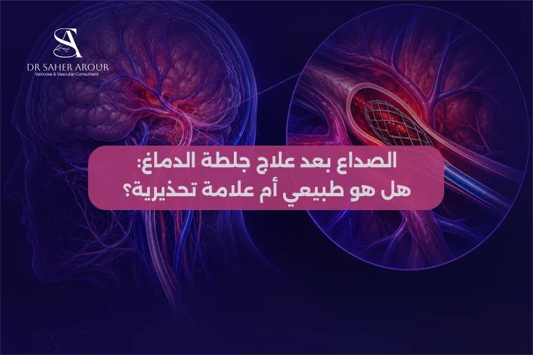 الصداع بعد علاج جلطة الدماغ