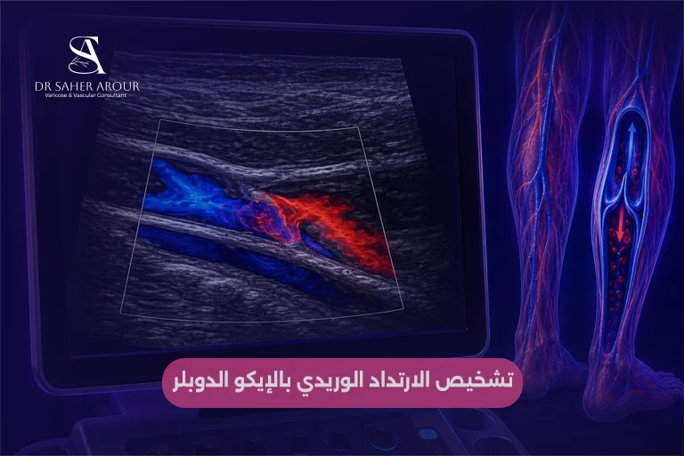 صورة داخلية 2 (الإيكو الوعائي الدوبلر لتأكيد الارتداد الوريدي المزمن)
