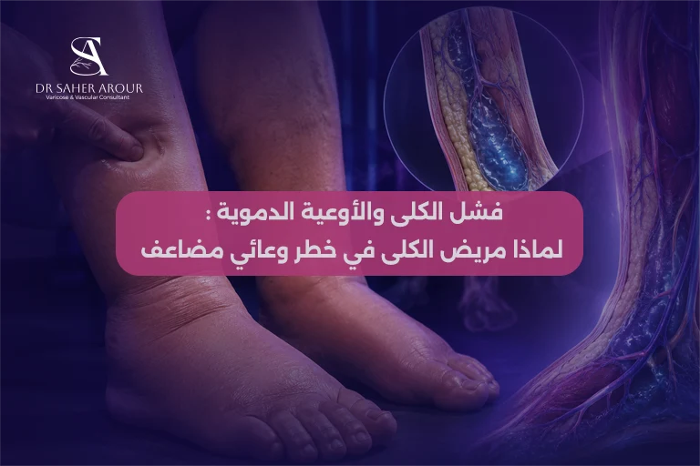 فشل الكلى والأوعية الدموية