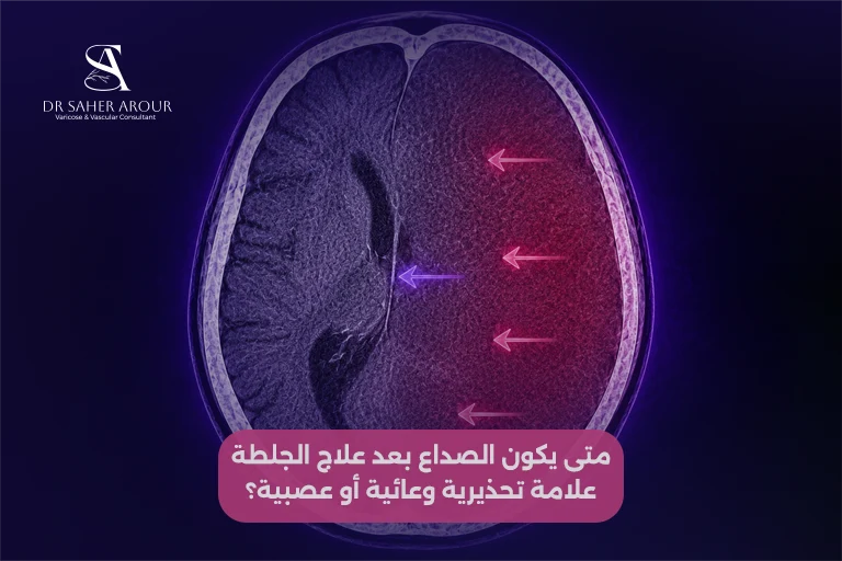 متى يكون الصداع بعد علاج الجلطة علامة تحذيرية وعائية أو عصبية