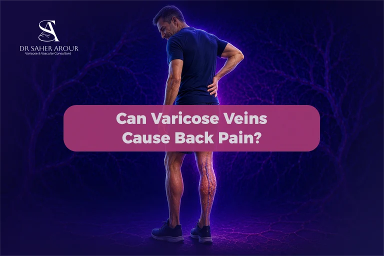 Can Varicose Veins Cause Back Pain