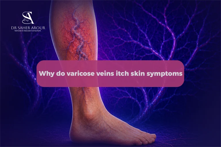 Why Do Varicose Veins Itch The Vascular Reason Behind the Skin Symptoms