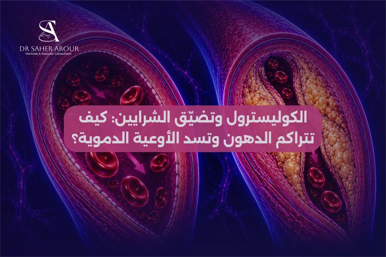 الكوليسترول وتضيّق الشرايين كيف تتراكم الدهون وتسد الأوعية الدموية
