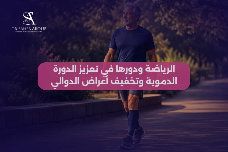 هل تختفي الدوالي بالرياضة تأثير التمارين على الأوردة
