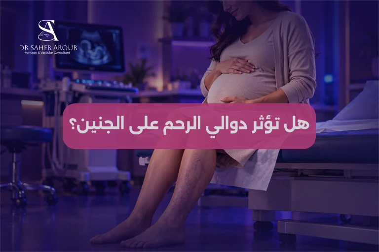 هل دوالي الرحم تؤثر على الجنين؟ الأعراض، المخاطر، والعلاج الآمن أثناء الحمل
